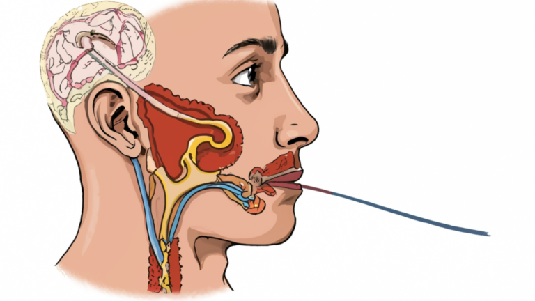 can you use a leaf blower wit heusphatian tube dysfunction